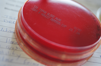 A close up image of 2 blood agar plates stacked on top of each other. No cultures can be seen. There is a page of handwritten notes underneath the plates.
