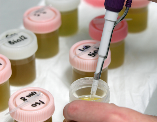A close up image of 2 rows of speciman containers with pink or white lids, all containing opaque greeny-yellow liquid. One is open and a pipette is shown extracting liquid.