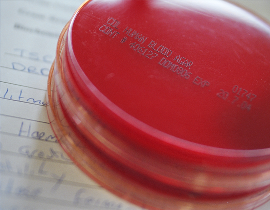 A close up image of 2 blood agar plates stacked on top of each other. No cultures can be seen. There is a page of handwritten notes underneath the plates.