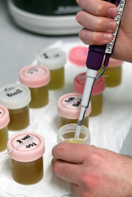 A close up image of 2 rows of speciman containers with pink or white lids, all containing opaque greeny-yellow liquid. One is open and a pipette is shown extracting liquid.